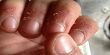 3 علاجات منزلية بسيطة سحرية لتقشير الجلد حول الأظافر