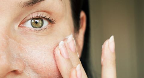 4 علامات تدل على أنكِ تعانين بشرة حساسة