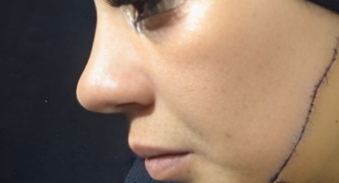 جريمة مروعة في مصر.. طليقة شاب تشوه وجه عروسه قبل ليلة زفافها